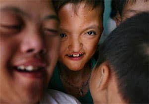 Không thể rũ bỏ trách nhiệm đối với các nạn nhân chất độc da cam/đi-ô-xin Việt Nam