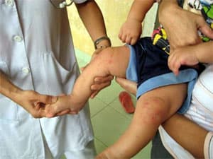 Có thể phòng và phát hiện bệnh sớm