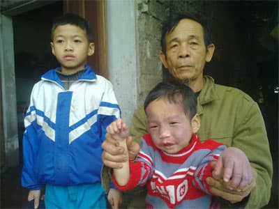 Giúp con anh Muôn chữa trị bệnh ung thư máu