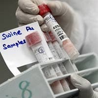 Phát hiện biến thể mới của virus cúm A/H1N1