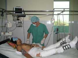 Cẩn trọng đề phòng tai nạn bỏng
