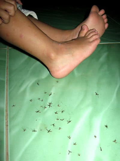 Mỏi tay vì... đập muỗi