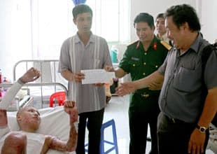 Giúp một học sinh nghèo bị bỏng nặng