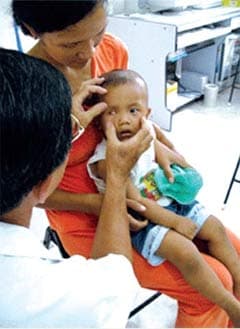 Bệnh đục thủy tinh thể ở trẻ em