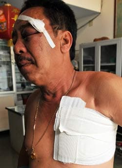 Cần xử lý nghiêm kẻ đánh người vô tội