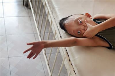 Triển lãm ảnh "Chất độc da cam ở Việt Nam" của Phi-líp Giôn Gri-phít