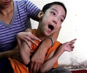 Len An-đi-xơ lại lên tiếng vì các nạn nhân chất độc da cam Việt Nam