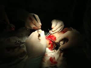 Cá dữ lại tấn công 2 người tắm biển Quy Nhơn