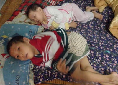 Hai cháu nhỏ bị bại liệt bẩm sinh cần sự giúp đỡ