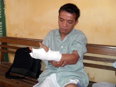 Đi đòi nợ, bị đánh vỡ đầu