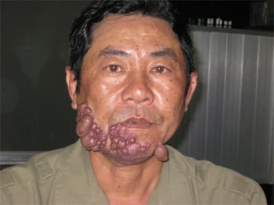 Một gia đình cựu chiến binh cần sự giúp đỡ