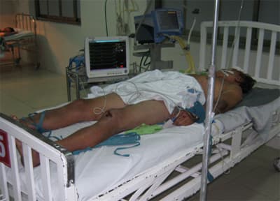2 trong 4 người bị thương đã tử vong