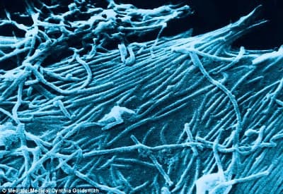 Vắc-xin dạng phun sương phòng bệnh Ebola