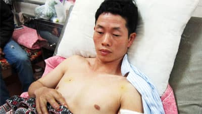 Nổ lò luyện thép: Hai người chết, nhiều người bị kim loại xuyên thấu
