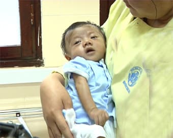 Phẫu thuật thành công ca dị tật tim bẩm sinh bằng kỹ thuật mới phức tạp nhất