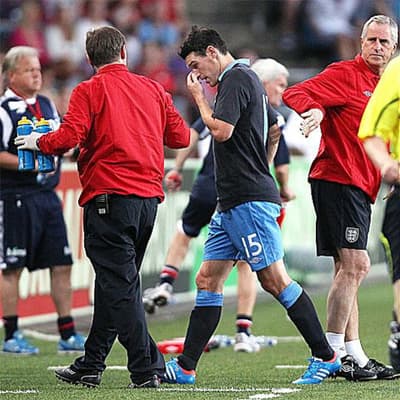 Anh mất 'máy quét' ngay trước Euro 2012