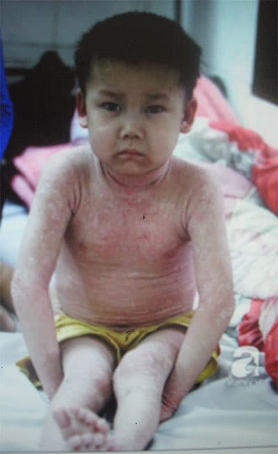 Cháu bé đáng thương mang căn bệnh kỳ lạ