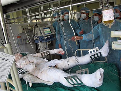 Vụ tai nạn cháy, nổ tại Nhà máy Z121: Các bệnh viện tập trung cứu chữa nạn nhân