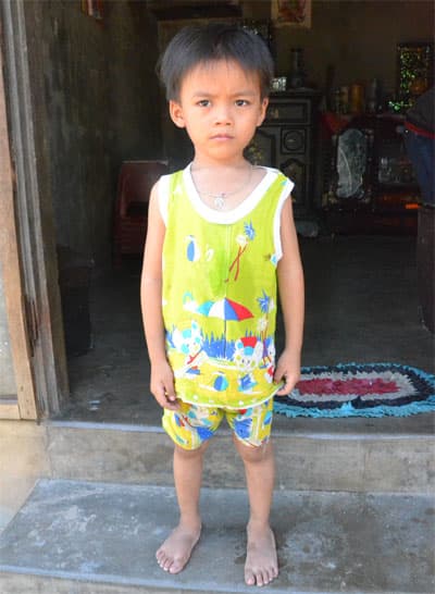 Cháu Gia Huy cần sự giúp đỡ