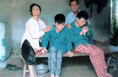Tỉnh cảnh một gia đình nạn nhân da cam