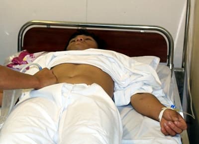 Quân y đảo Phan Vinh phẫu thuật cấp cứu ngư dân bị tai nạn trên biển