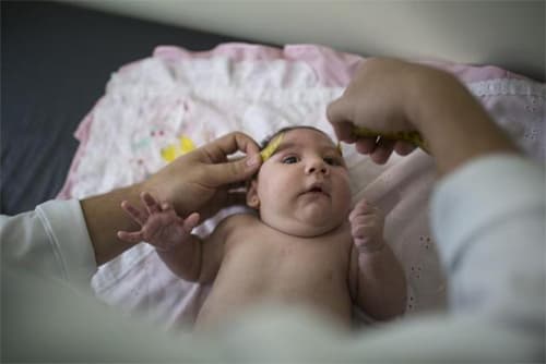 Brazil: WHO quá thận trọng về mối liên quan giữa virus Zika với bệnh đầu nhỏ