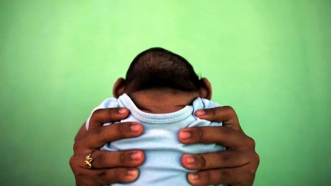Em bé đầu tiên nhiễm virus Zika chào đời tại Guatemala
