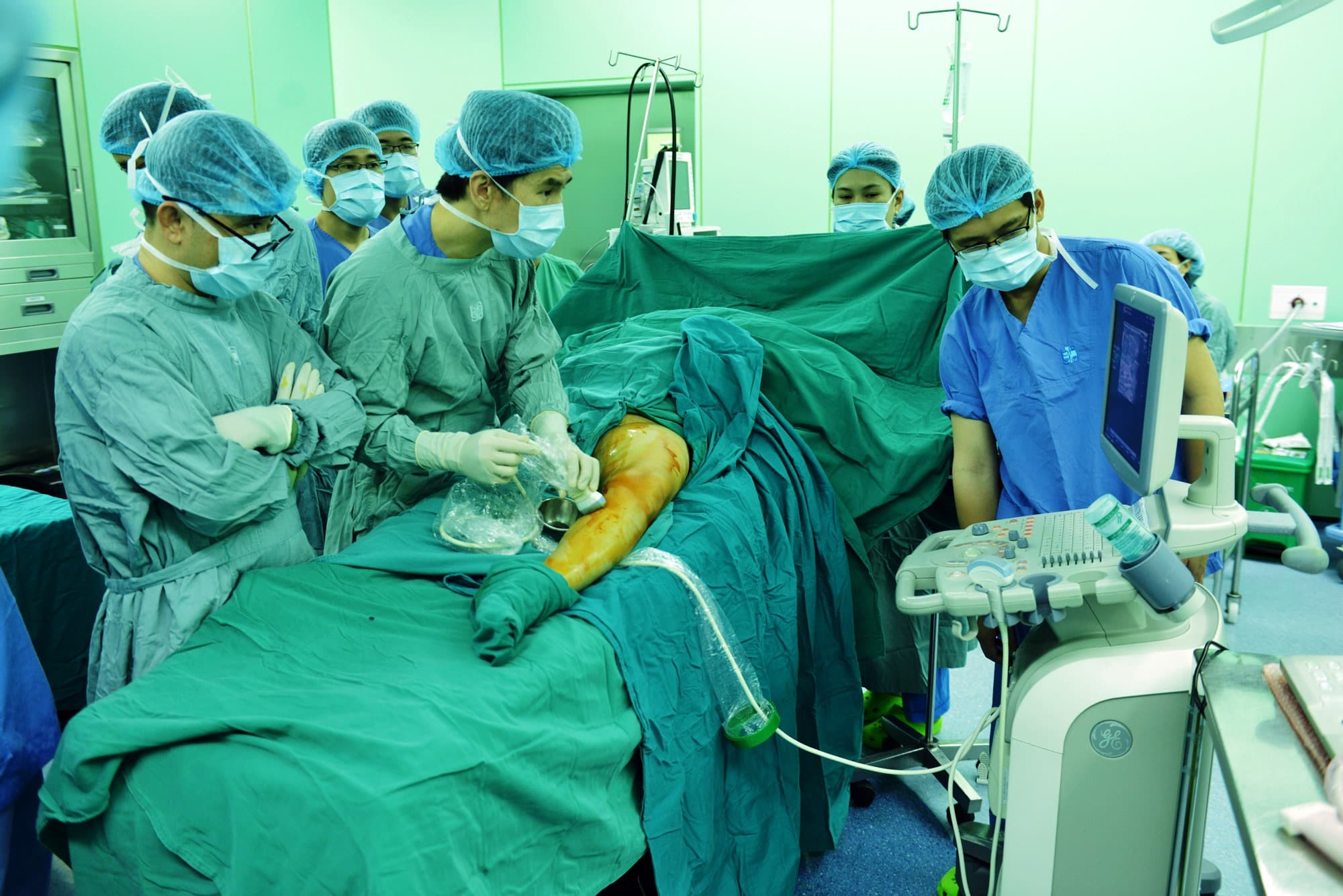 Ứng dụng keo sinh học trong điều trị bệnh suy giãn tĩnh mạch nông chi dưới