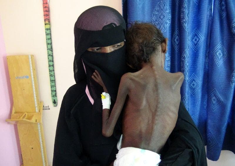 Cơ hội hòa bình đến muộn ở Yemen