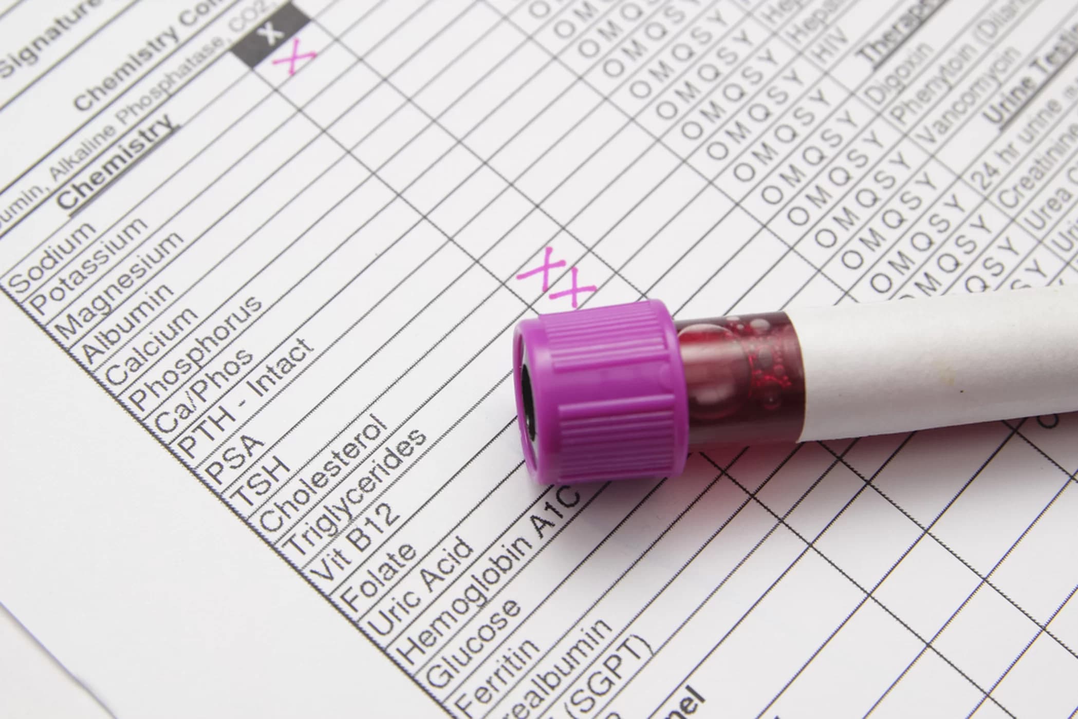 Nồng độ cholesterol thấp có thể gây ra nhiều vấn đề sức khỏe