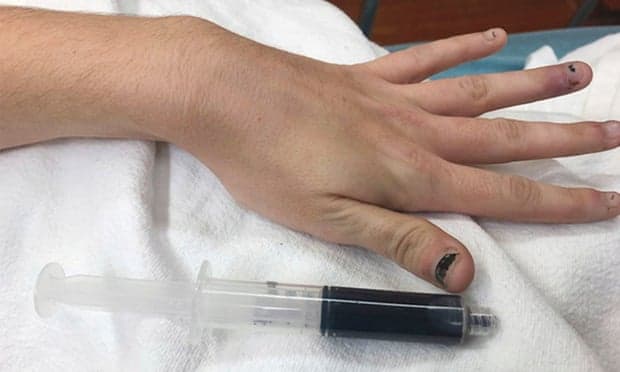 Cảnh báo từ việc lạm dụng thuốc giảm đau