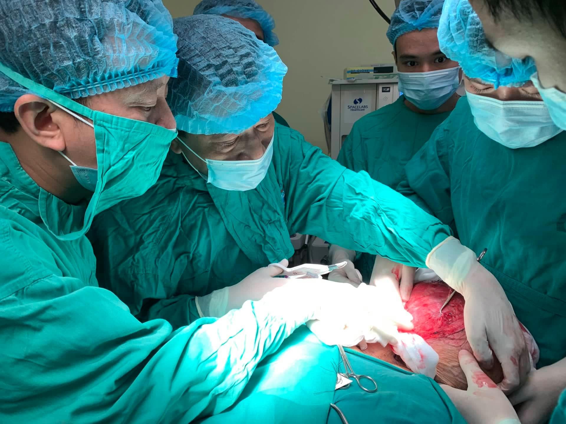 Bệnh viện K phẫu thuật thành công cho bệnh nhân có khối u khổng lồ