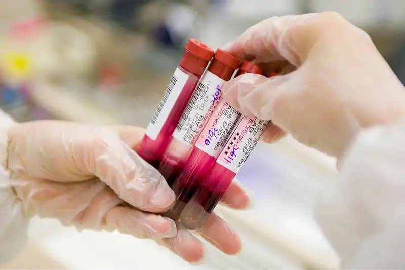 Xét nghiệm máu phát hiện hàng chục bệnh ung thư