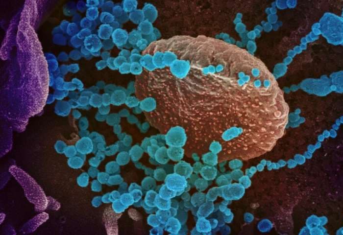 Lập bản đồ phản ứng miễn dịch với virus từ bệnh nhân Covid-19