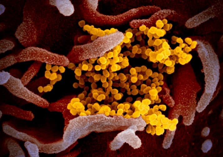 Virus Covid-19 gây bệnh cho cơ quan nào của cơ thể?
