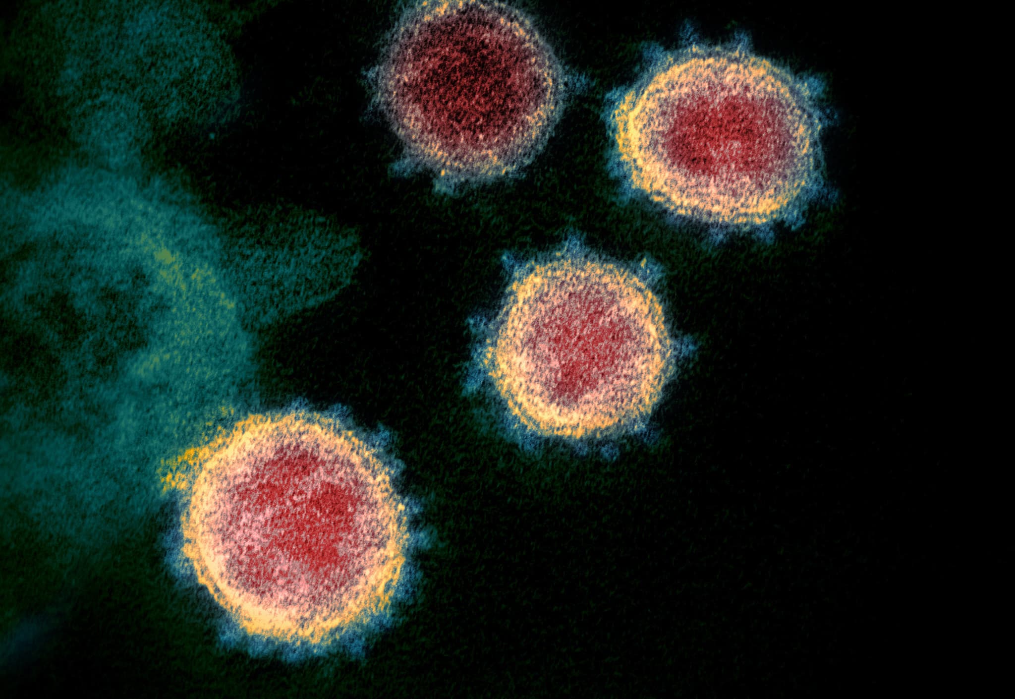 Virus SARS-CoV-2 lây lan nhanh hơn con người ước tính