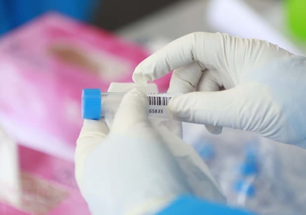 Hải Dương: Đình chỉ công tác cán bộ CDC làm giả giấy xét nghiệm SARS-CoV-2