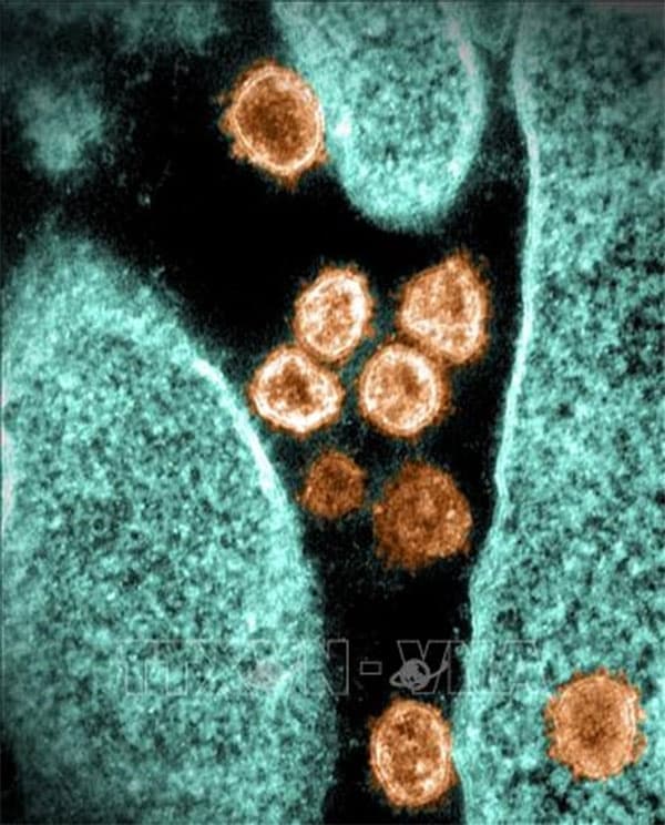 Tình báo Mỹ ra kết luận về nguồn gốc virus SARS-CoV-2