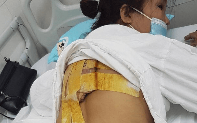 Biến chứng nguy hiểm từ việc dùng thuốc không đúng cách
