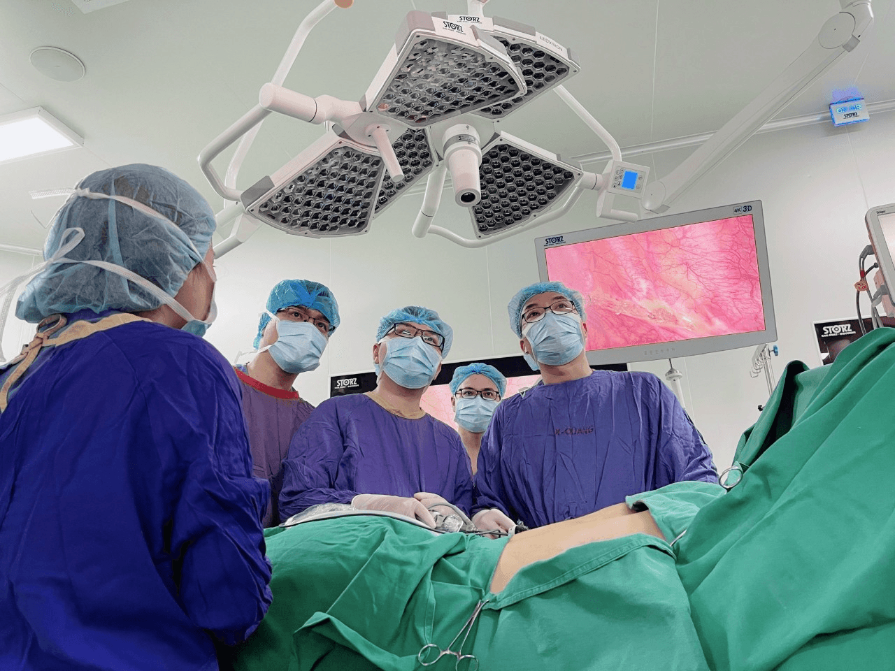 Phiền toái bởi chứng tăng tiết mồ hôi