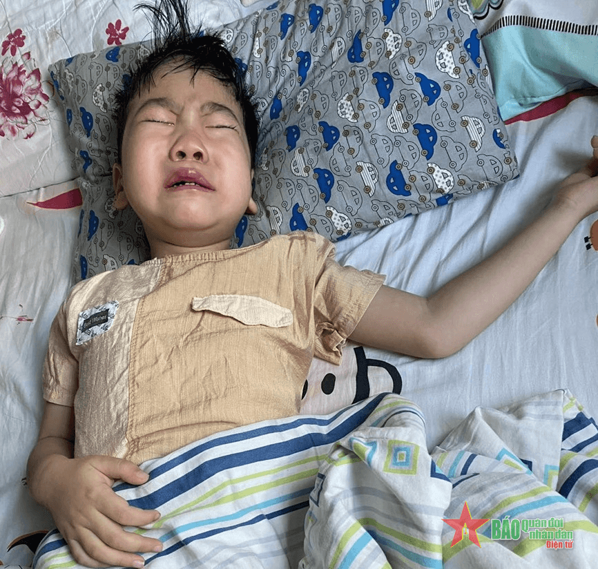 Cháu bé bị viêm não úng thủy là con bộ đội mong được giúp đỡ