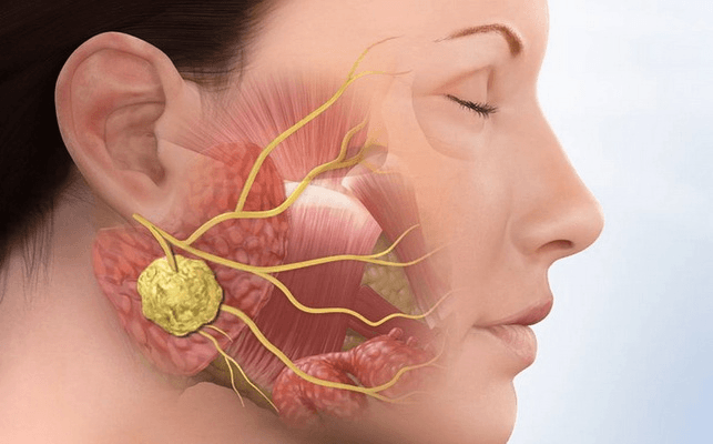 Bác sĩ của bạn: Chữa vô sinh cho bệnh nhân bị biến chứng do mắc quai bị