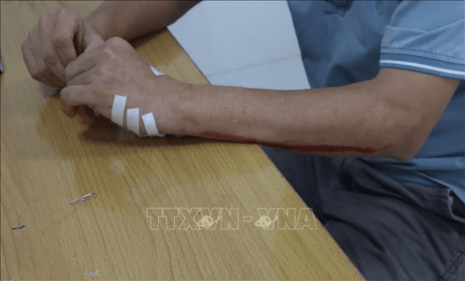 Điều tra, làm rõ vụ người nhà bệnh nhân hành hung nhân viên y tế