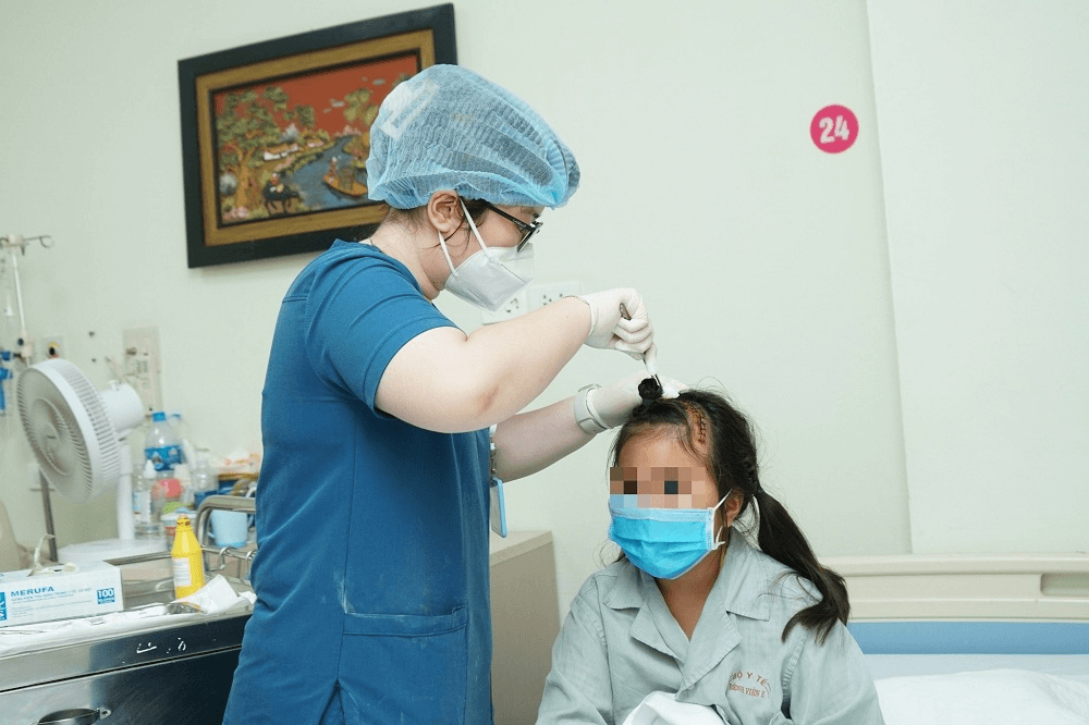 Phẫu thuật thành công khối u màng não lớn cho bệnh nhi 9 tuổi