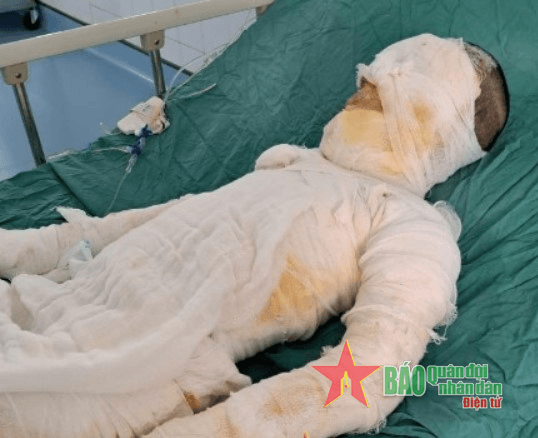 Sau hỏa hoạn, gia đình chị Trang rất cần được giúp đỡ