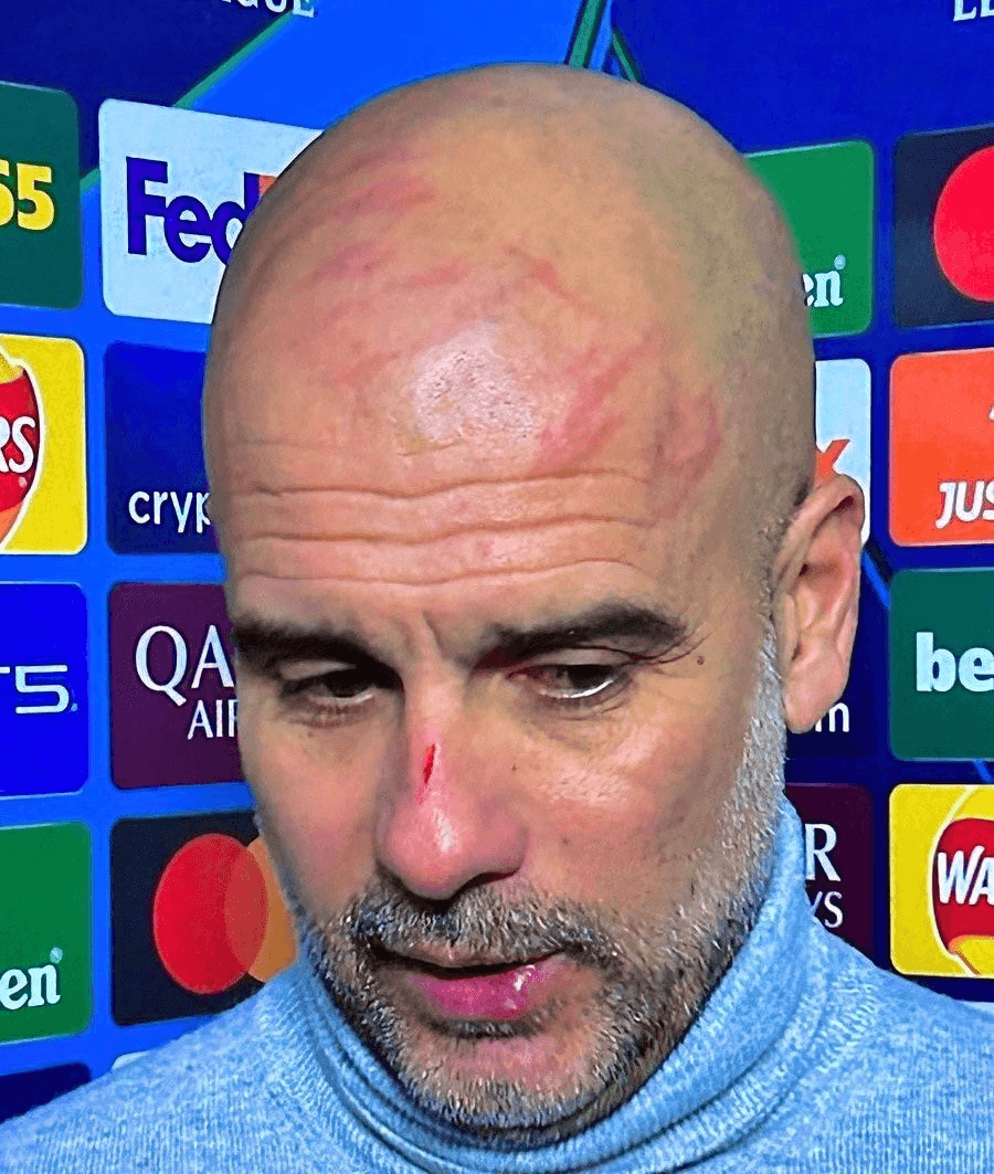 HLV Pep Guardiola tự cào mặt khi Man City hòa cay đắng