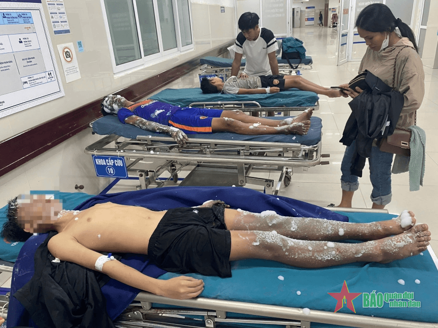 Quảng Bình: Tự chế pháo nổ, 4 học sinh bị bỏng