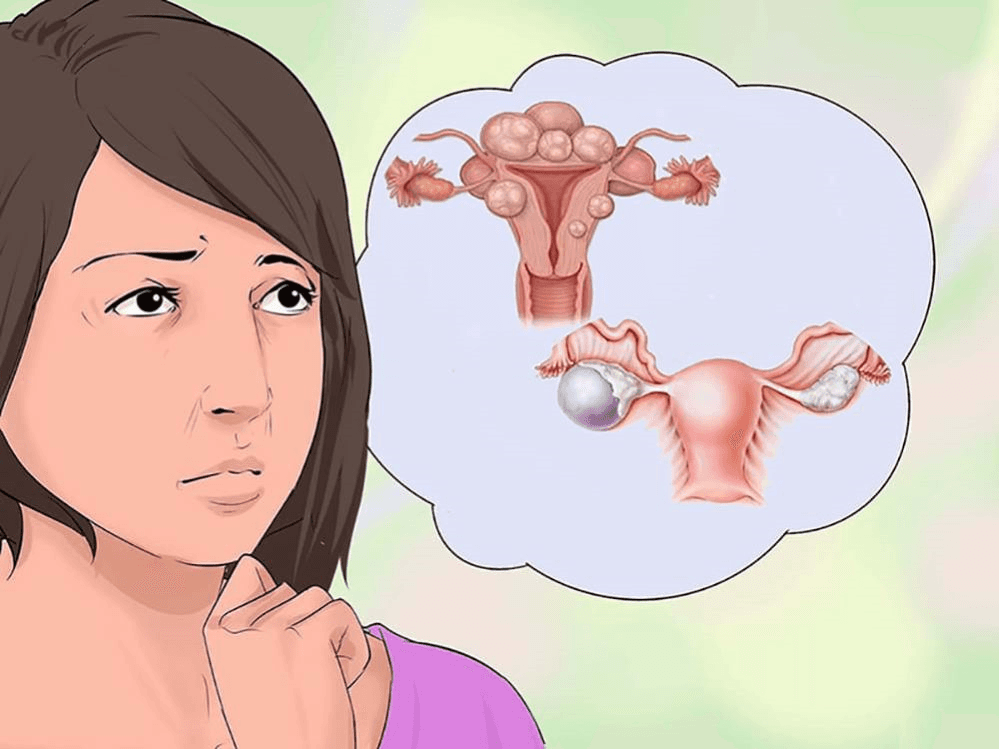 Rối loạn tâm thần do khối u buồng trứng