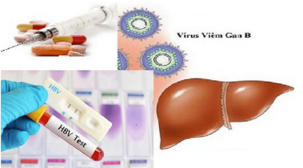 Nguy hiểm khi tự ý bỏ thuốc điều trị viêm gan B