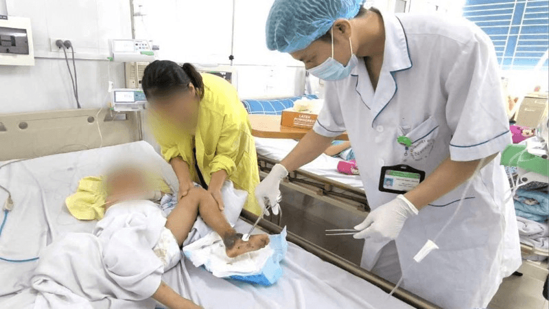 Bé trai 4 tuổi nhiễm khuẩn huyết sau khi đắp thuốc nam chữa vết mèo cào